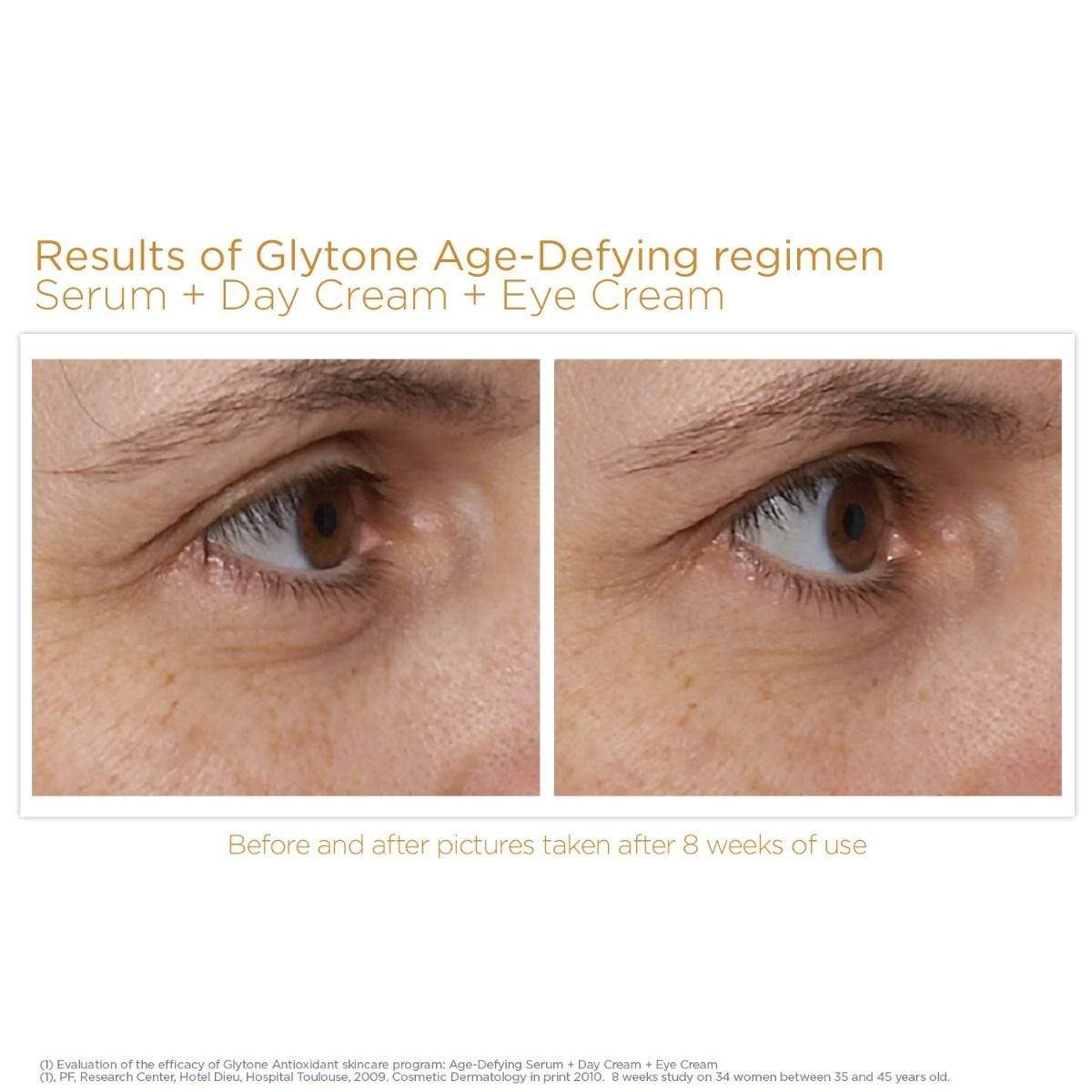 Glytone Age Defying Antioxidant Eye Cream Before &amp; After Image 2